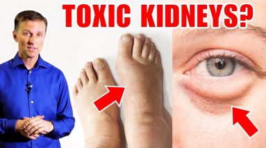 7 Warning Signs That Your Kidneys Are Toxic