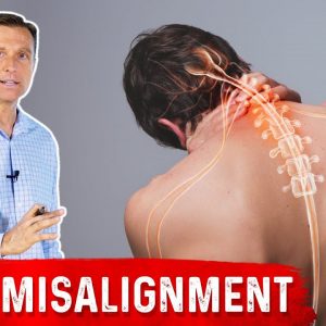 Chronic Neck Misalignment Does Not Come From the Neck