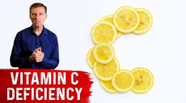Eighty-two Percent of COVID-19 Patients Were Deficient in Vitamin C