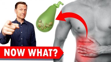 Gallbladder Surgery (Removal)? WATCH THIS!