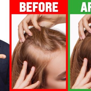 Grow THIN Hair Into THICK Hair - Dr. Berg