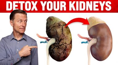 A Surprising Way to Cleanse Toxic Kidneys - Dr. Berg on Kidney Detoxification
