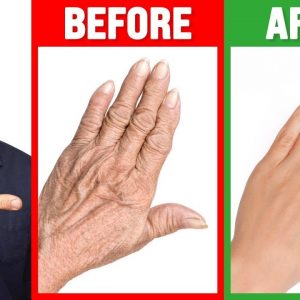 #1 Absolute Best Remedy for Dry and Wrinkled Hands