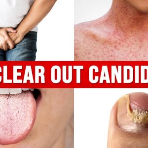 The ONLY Way to Cure Candida for Good