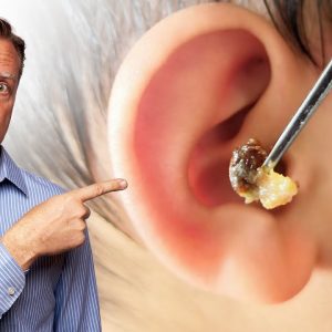 What Does LOTS of EARWAX Buildup Mean?