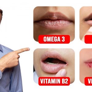 5 Things Your LIPS Can Tell You about Your Nutritional State