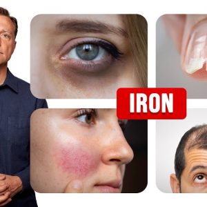 How Iron Affects Your Hair, Skin and Nails