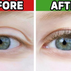 #1 Best Remedy for Eyelashes that are Falling Out