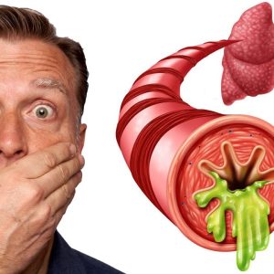 The 3 Causes of Constant Mucus (Phlegm) in Your Throat