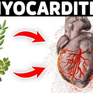 The Best Remedies for Myocarditis