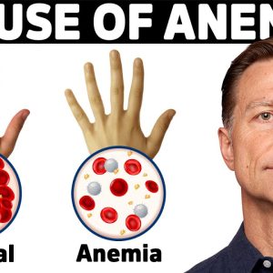 The Hidden Cause of Anemia You've Never Heard About