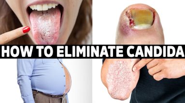 NEVER Get Candida Again