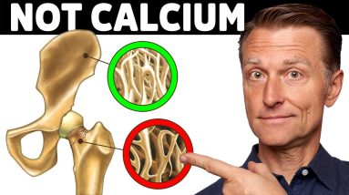Osteoporosis Is NOT a Calcium Problem