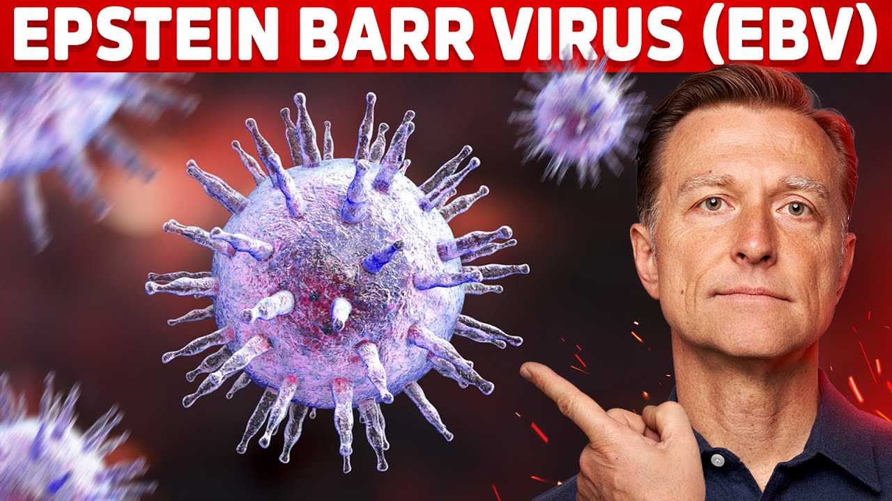 The 5 Things You MUST Know About EpsteinBarr Virus (EBV)