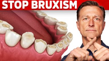 The Best 2 Remedies for Teeth Grinding (Bruxism)