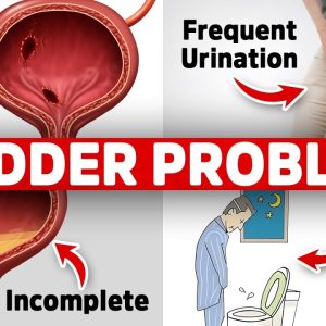 The #1 Vitamin Deficiency behind Bladder Issues (Freq. Urination, Leaky, Urgency)