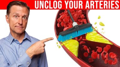 The #1 Best Remedy to Clean Out Your Arteries