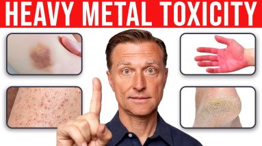 Identifying Heavy Metal Toxicity on Your Skin
