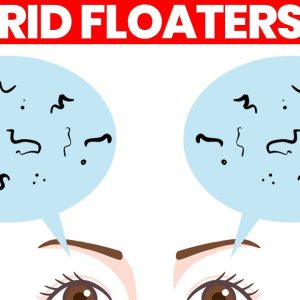 Eye Floaters: What Are They & How to Get Rid of Them
