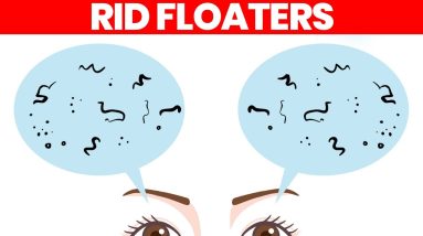 Eye Floaters: What Are They & How to Get Rid of Them