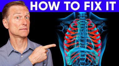 The #1 Best Way to Fix Costochondritis (RIB CAGE)