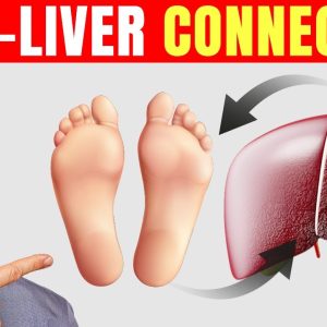 How to Use Your Feet to Diagnose Liver Problems—Dr. Berg Explains