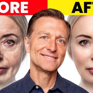 The Ultimate Face Transformation–Dr. Berg's Best Remedy for Dry Skin and Wrinkles