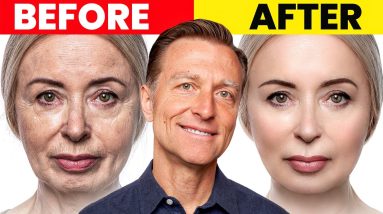 The Ultimate Face Transformation–Dr. Berg's Best Remedy for Dry Skin and Wrinkles