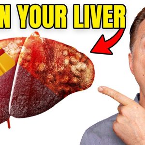 Top BEST Foods to Clean Out Your Liver