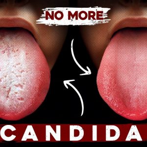 A Better Way to Eliminate Candida for Good