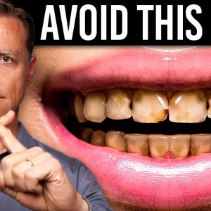 The Worst Food for Your Teeth Is NOT SUGAR