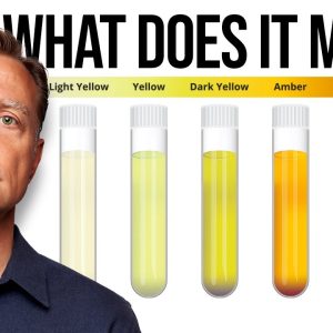 What Your Urine Color Says about Your Health