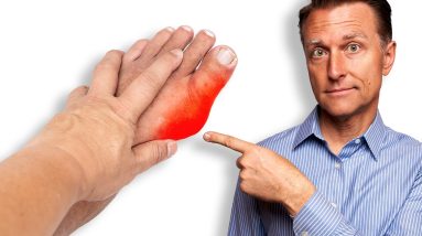 The Ultimate Remedy for Gout and Uric Acid