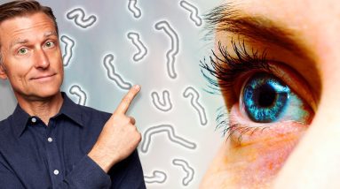 What Causes Eye Floaters and Dry Eyes?