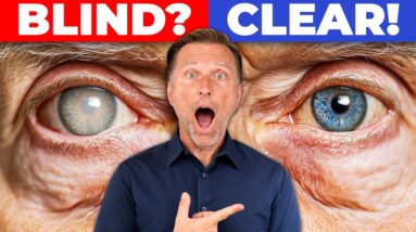 The #1 Best Remedy for Cataracts