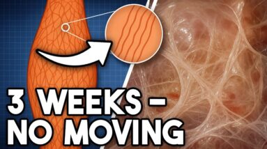 This Is Why I Stretch EVERY DAY (FASCIA) – Dr. Berg